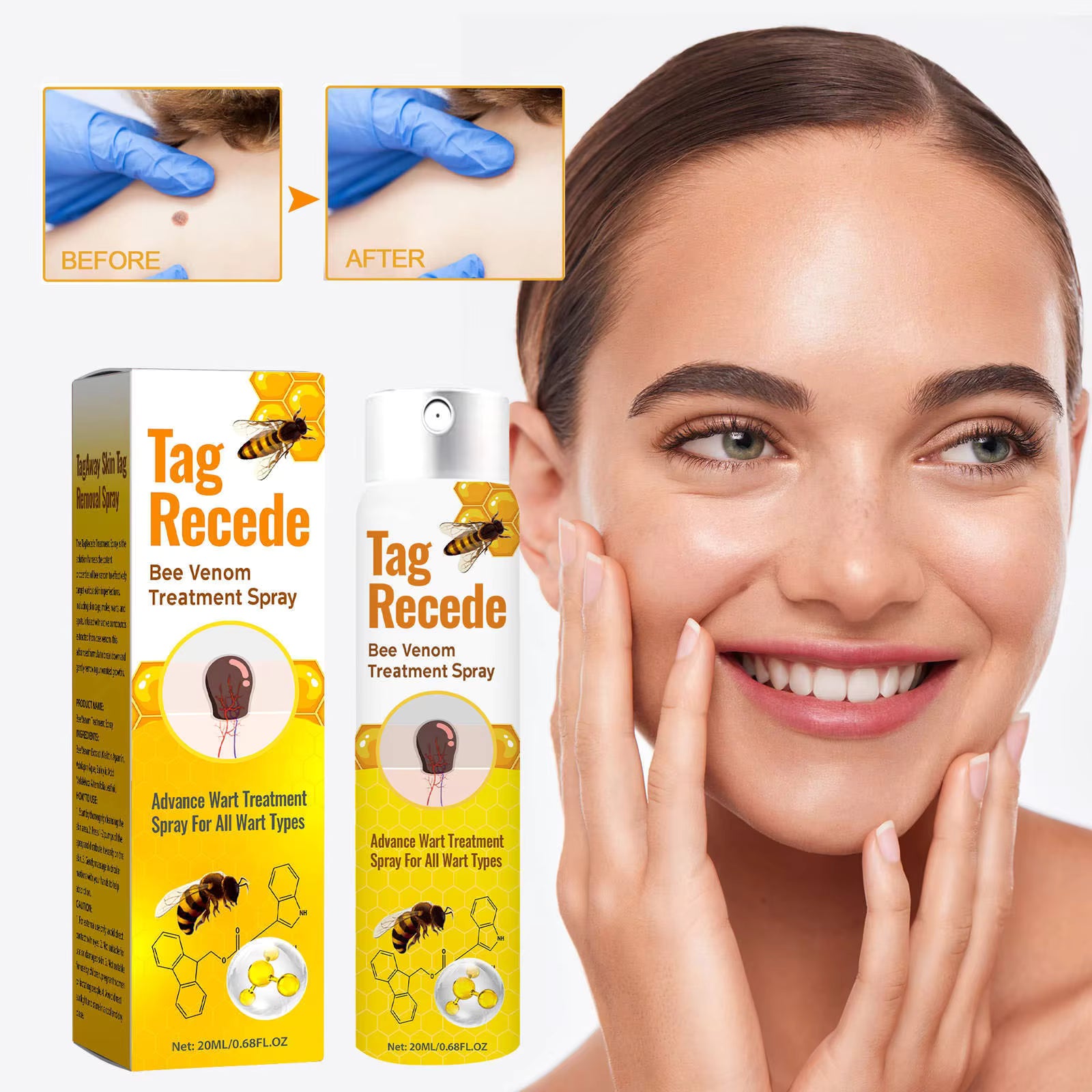 Tag Recede Bee Venom Repair Spray – Advanced Skin Tag & Wart Care | Natural Bee Venom Skin Repair Spray for Smooth Healthy Skin